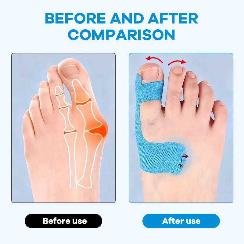 Pre-Cut Bunion Support Patches — Invisible, Shoe-Compatible Fit for Everyday Comfort and Foot Correction
