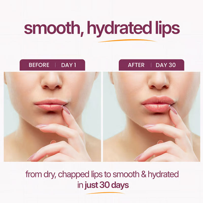 Vitamin Skin Calcium Ion silmänympärysvoide