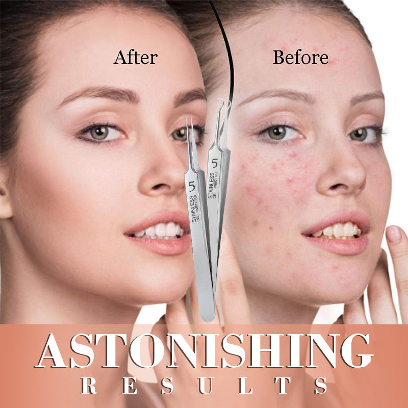 🔥 Limited-time offer ⏳🔍 Tweezers designed specifically for beauty salons